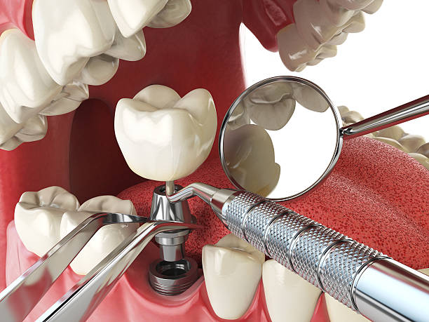 Professional Emergency Dentist in NH